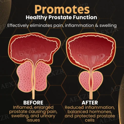 Prostese™ Bee Venom Detox Prostate Care Patch - Highly Recommended by Medical Experts!