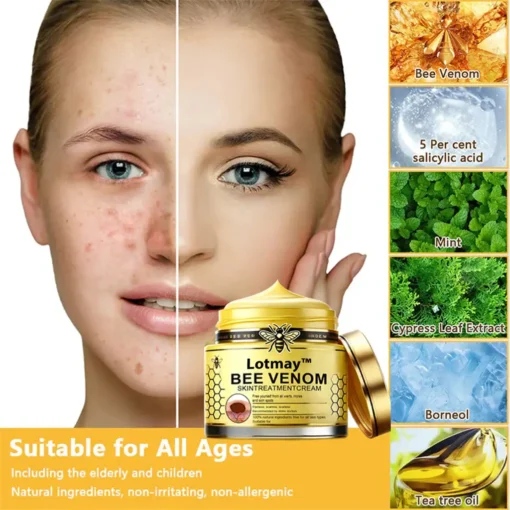 [Winter-Skincare] Lotmay™ Bee Venom Skin Treatment Cream（AAD RECOMMENDED）