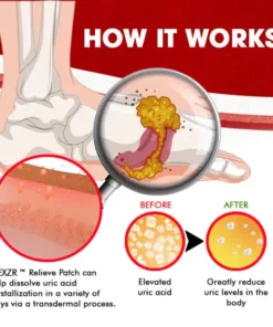 AEXZR™ Gout Relieve Patch