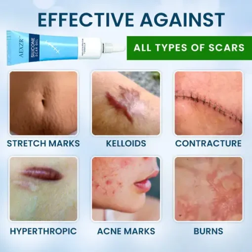 AEXZR™ Silicone Scar Gel - Image 2