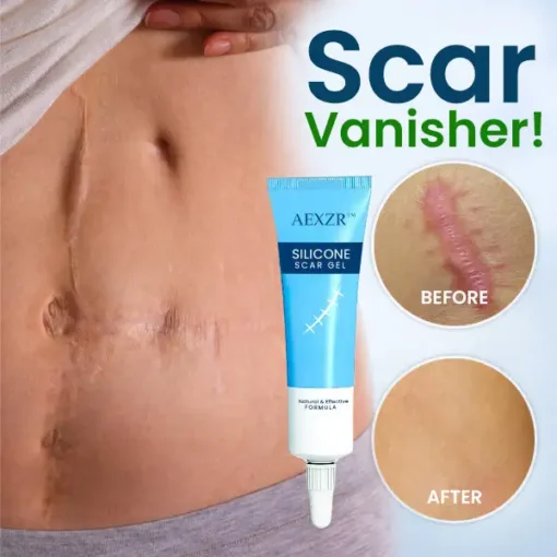 AEXZR™ Silicone Scar Gel - Image 3