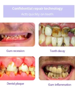 AEXZR™ Teeth Restoration Mineral Powder