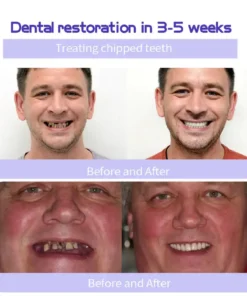 AEXZR™ Teeth Restoration Mineral Powder