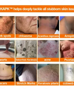 APKAPK™ Effective All-in-One Skin Treatment Cream