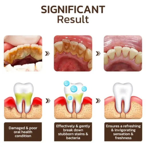 Fivfivgo™ Niacinamide Whitening Toothpaste - Image 5