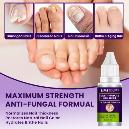 LIMETOW™ Multi-Purpose Nail Repair - Image 3