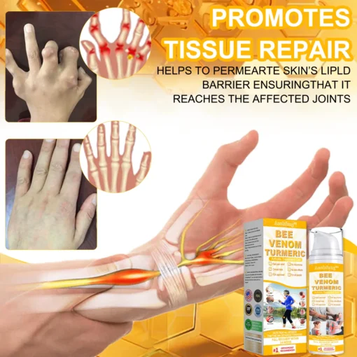 Lotmay™ Bee Venom & Turmeric Arthritis Treatment Gel