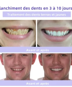 Oyikey™ Teeth Restoration Poudre Minérale