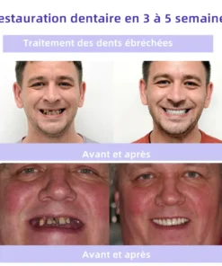 Oyikey™ Teeth Restoration Poudre Minérale