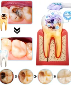 Oyikey™ Teeth Restoration Poudre Minérale