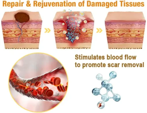 flysmus™ Lidocaine Scar-Free Pain Relief Healing Liquid - Image 5