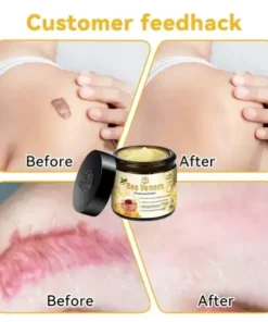 TLOPA® Bee Venom Skin Treatment Cream