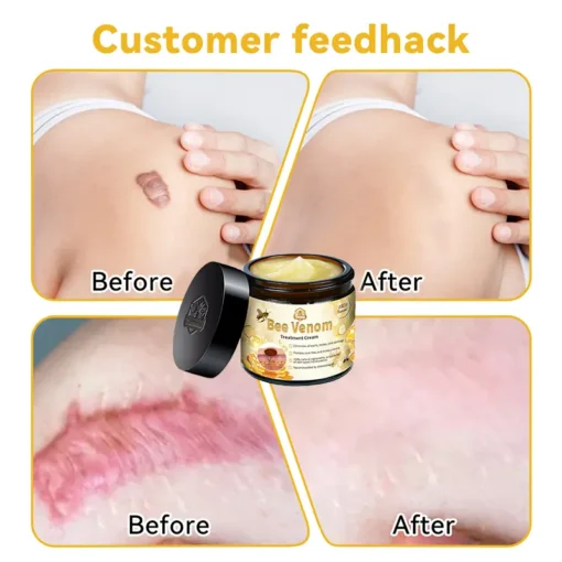 Turonu™ Bee Venom Therapy Cream - Image 5