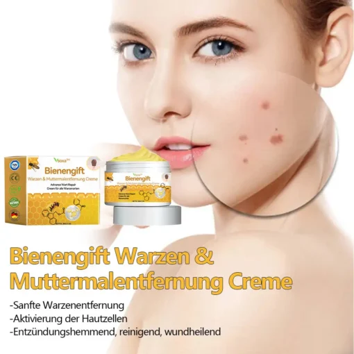 Vsoxa™ Bienengift Waren & Muttermalenfernung Creme - Image 10